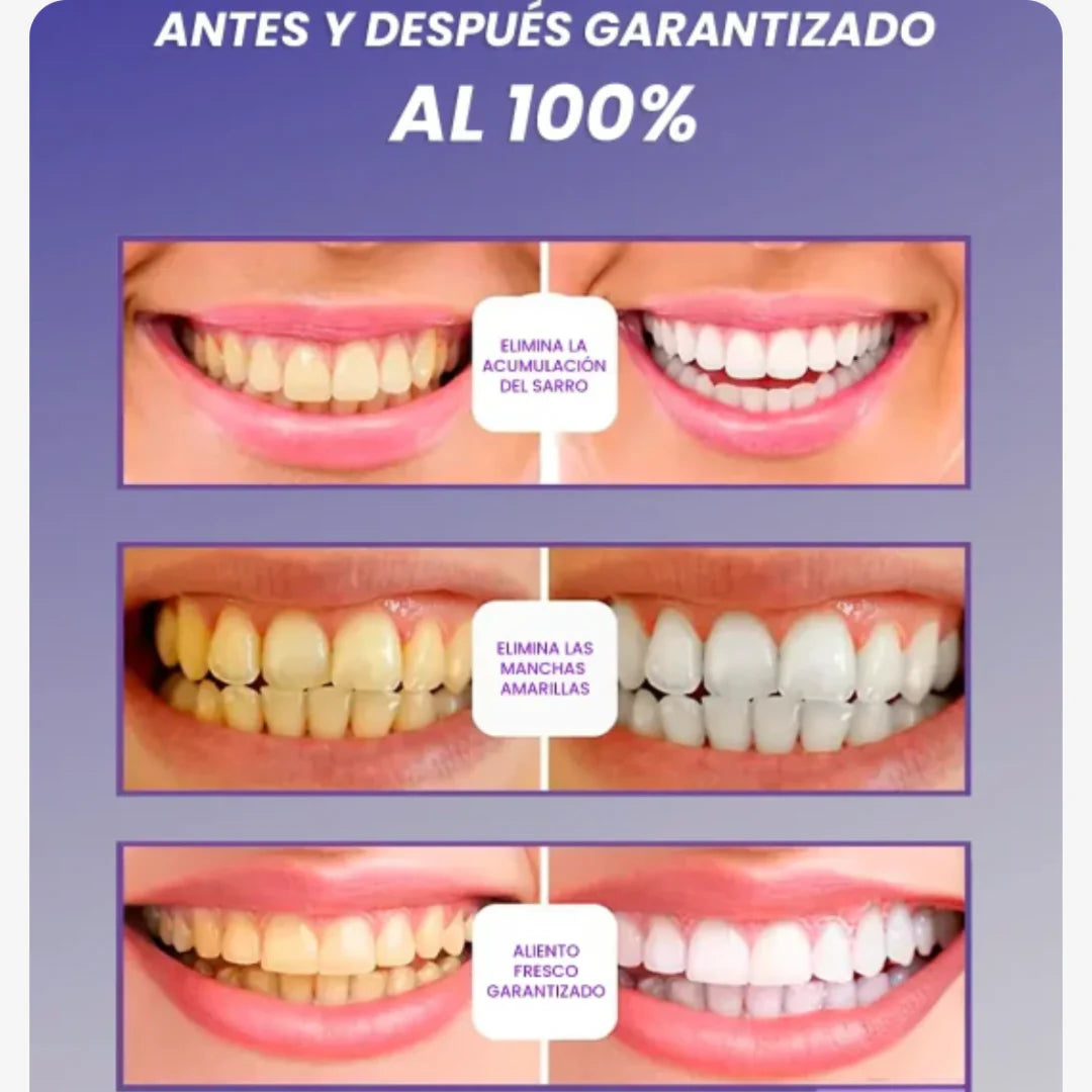 Blanqueador Dental V34